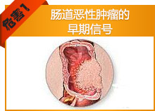 肠道恶性肿瘤的早期信号