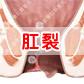 肛裂