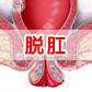 肛门脱出是怎么回事？