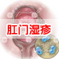 肛门湿疹<肛门湿疹百科>
