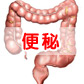 便秘的病因分析及快速治疗