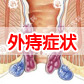治疗外痔疮需要开刀治疗吗