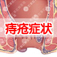 痔疮的症状有哪些?你知道吗?