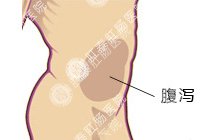 腹泻百科