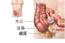 急性肠炎百科