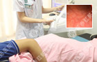 急性肠炎的症状及治疗