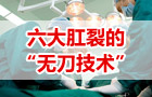 肛泰治疗肛裂的六大“无